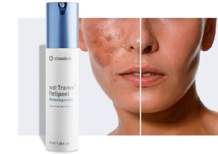 rešenje problema hiperpigmentacije